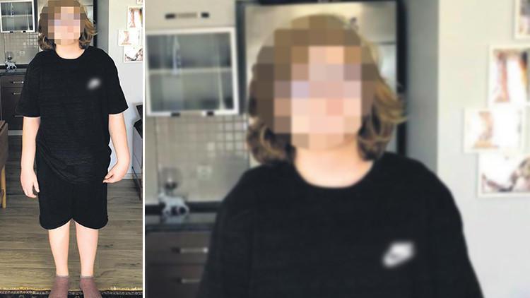 Küçük çocuk feci şekilde yanmıştı! Okul müdürü ve kantin işletmecisinin cezası belli oldu