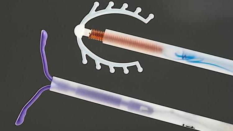 Spiral nedir? Spiral nasıl takılır?