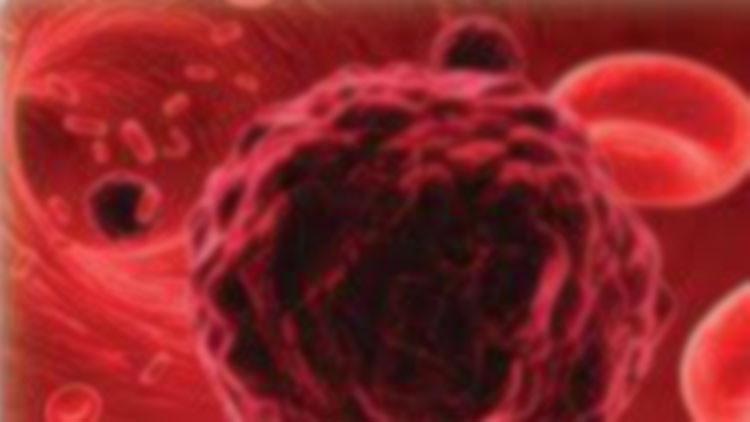Sigara ve obezite lösemi ihtimalini iki kat artırıyor