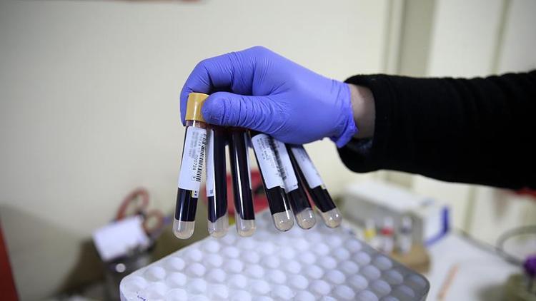 Ferritin nedir? Ferritin eksikliği neden olur?