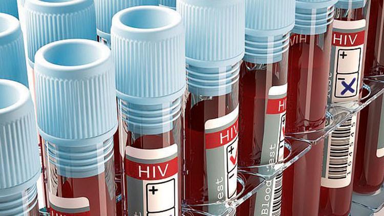 AIDS’e karşı umut ışığı