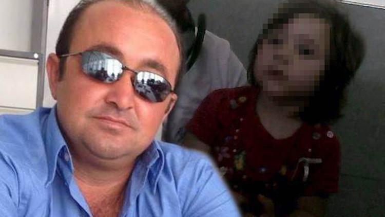 Cani baba 3,5 yaşındaki kızını hastanelik etti