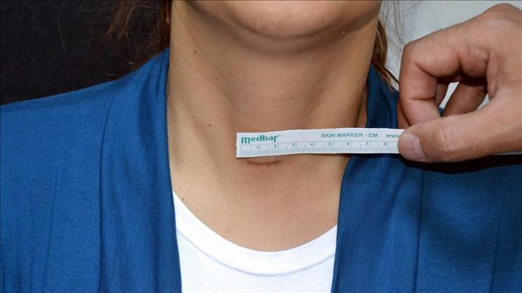Zehirli guatr nedir?