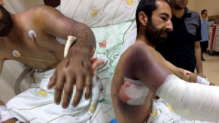 Diyarbakır'da korkunç olay! Yılan bu hale getirdi...