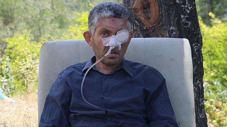 Dişini çektirdikten sonra gözünü kaybettiği iddia edilmişti! Hatay Valiliği'nden açıklama geldi