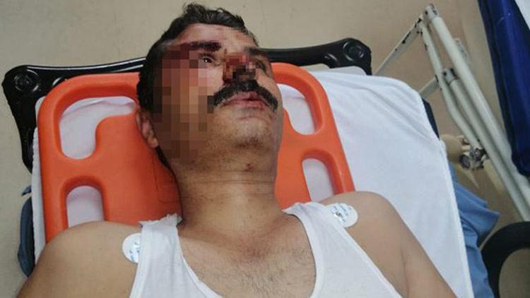 İzmit'te sendikacıya muştalı saldırı