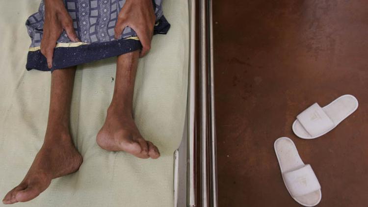 Nijerya'da her gün 47 çocuk ya da genç AIDS nedeniyle ölüyor