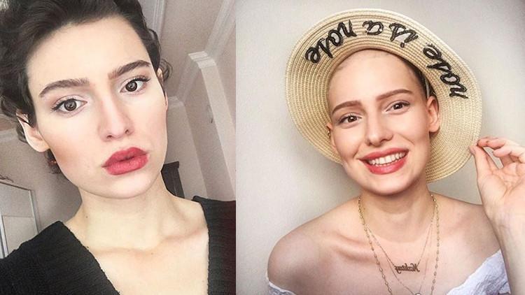 Neslican için hastaneden son dakika açıklaması