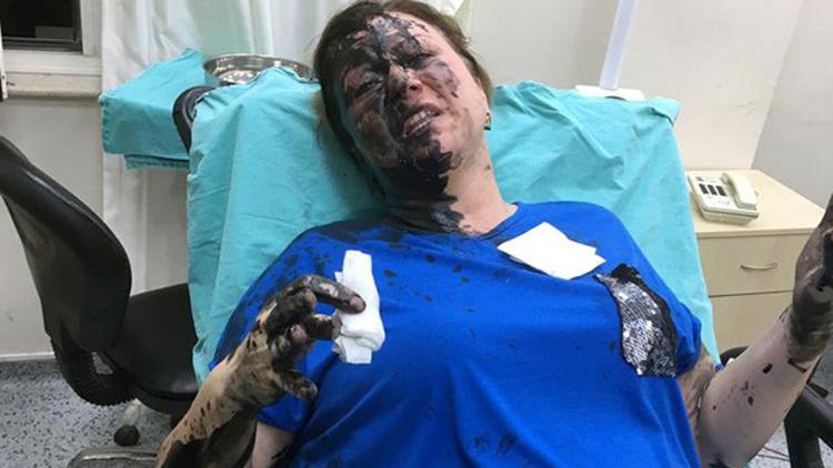 Dövüp üzerine siyah sıvı dökmüşlerdi! Savcı itiraz etti, tutuklandı