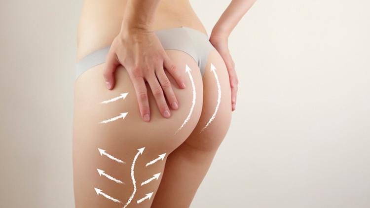 Microfat Grafting Tekniği İle Popo Büyütme