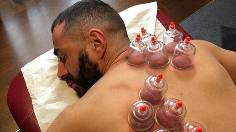 Karim Benzema hacamat yaptırdı