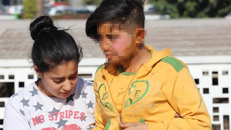 Şanlıurfa’da vahşet! Kendisini ihbar eden genç kızı yaktı…