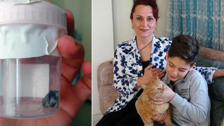 19 yıl bu kurşunla yaşadı... "3 TL'lik bir mermiyle ne erkek olunur ne de..."