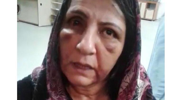 Öz annesini bu hale getirmişti... Flaş gelişme!