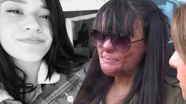 Son dakika haberi: Berfin'in yüzüne asit atmıştı! İsyan ettiren ceza...