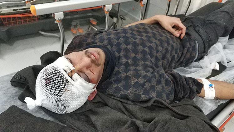 Sopalı vahşet! Kapıyı kırıp girdiler