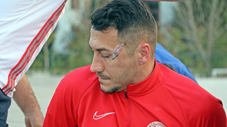 Antalyaspor'dan Adis Jahovic korkuttu! Kafasında çatlak tespit edildi