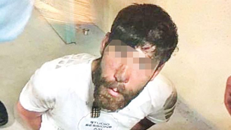 Silahını kaptı polisi vurdu