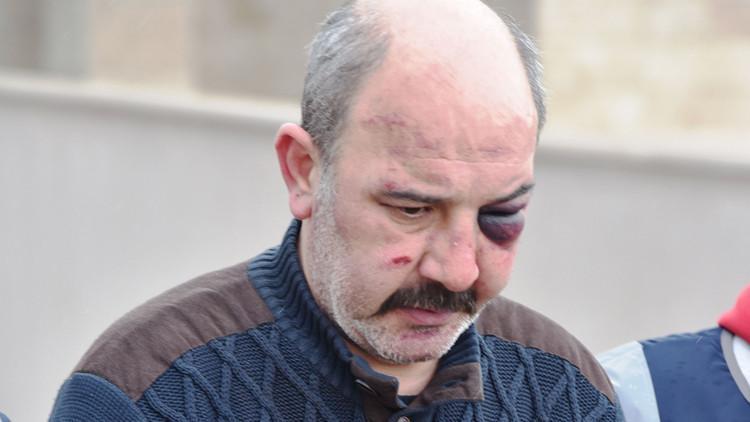 'Kadın müşteriye baktın' kavgası: 1 ölü