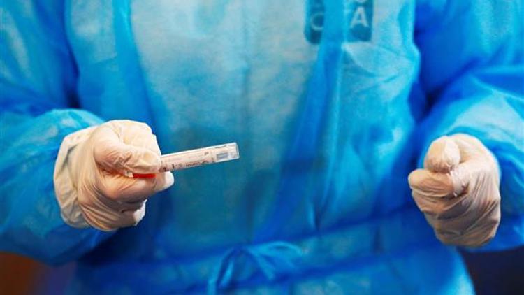 İran'da 35 günlük bebekte Corona Virüs tespit edildi