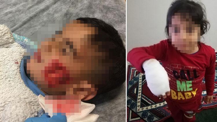 Şanlıurfa'da dehşet! 6 çocuğu yaraladılar, 3’ünün durumu ağır!