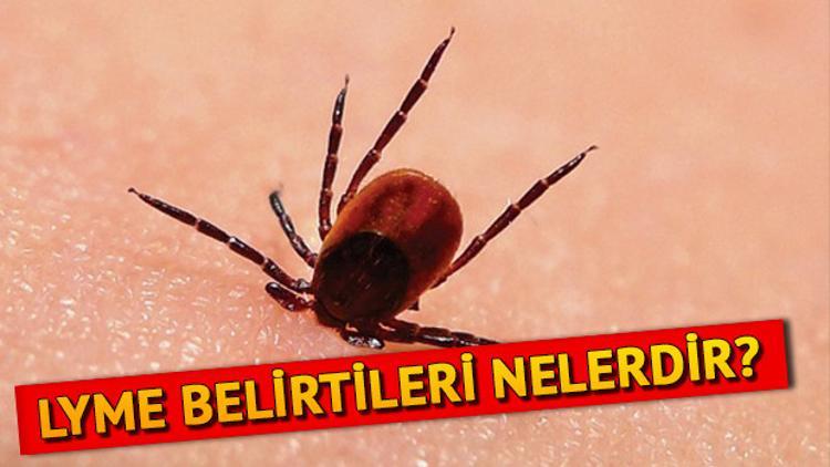 Lyme hastalığı nedir, belirtileri nelerdir? Lyme hastalığı tedavisi var mı?