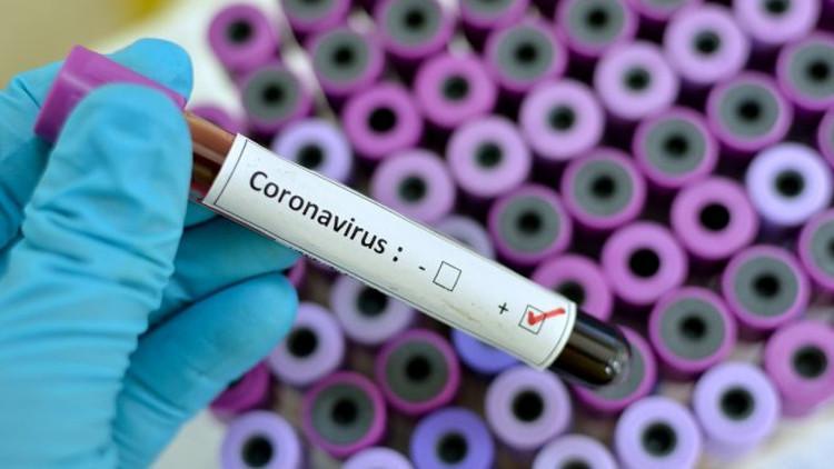 ABD'deki yeni araştırmaya göre D vitamini eksikliği Kovid-19'dan ölüm riskini artırabilir