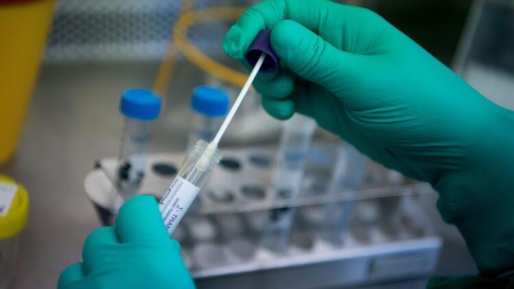 PCR testi nedir, Corona Virüs'te PCR testi nasıl yapılır? - Son Dakika  Haberler