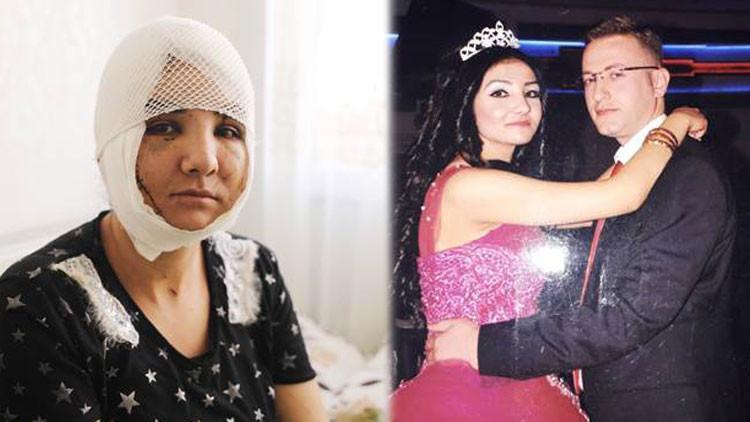 Kıskançlık vahşeti! '45 dakika sürdü, yüzümü ve boğazımı kesti'