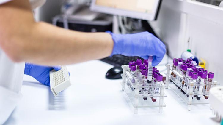 Estradiol nedir? Estradiol değeri kaç olmalıdır? Düşüklüğü ile yüksekliği nedenleri ve belirtileri