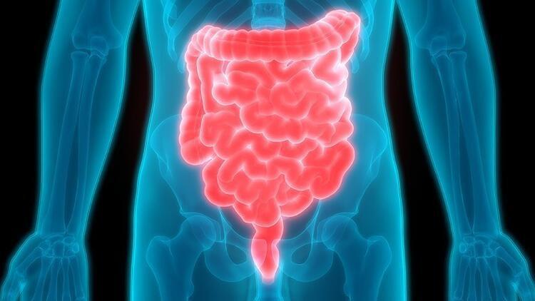 Crohn hastalığı nedir, belirtileri neler? Crohn hastalığı ile ilgili bilgiler