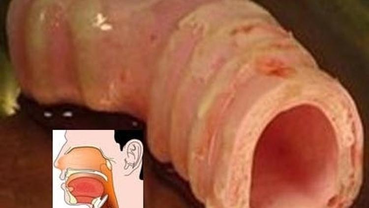 Kansere Çare mi Bulunuyor?