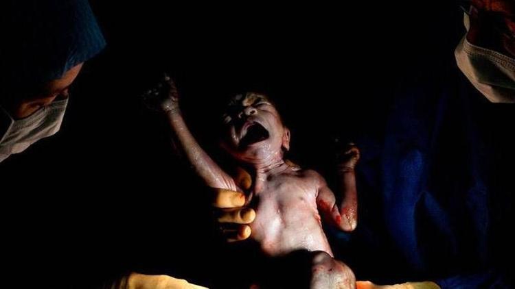 Doğdukları anda fotoğraflanan 10 bebek