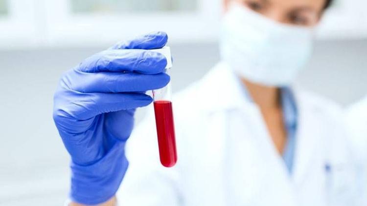 Anti HCV nedir? Anti HCV yüksekliği ve düşüklüğü