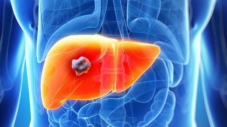 Siroza immunoterapi ile çözüm