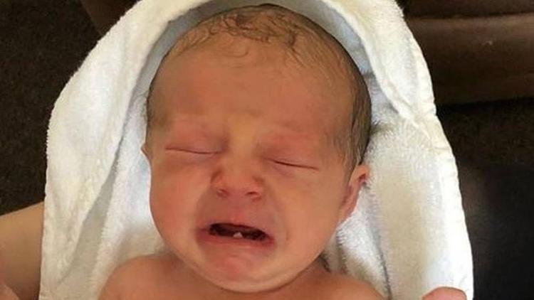 Henüz 12 günlük bebeğin dişi çekildi