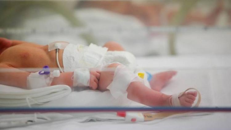 Dünyada her yıl milyonlarca bebek erken doğuyor!