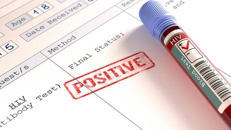 HIV virüsü taşıyanlar çocuk sahibi olabilir mi?