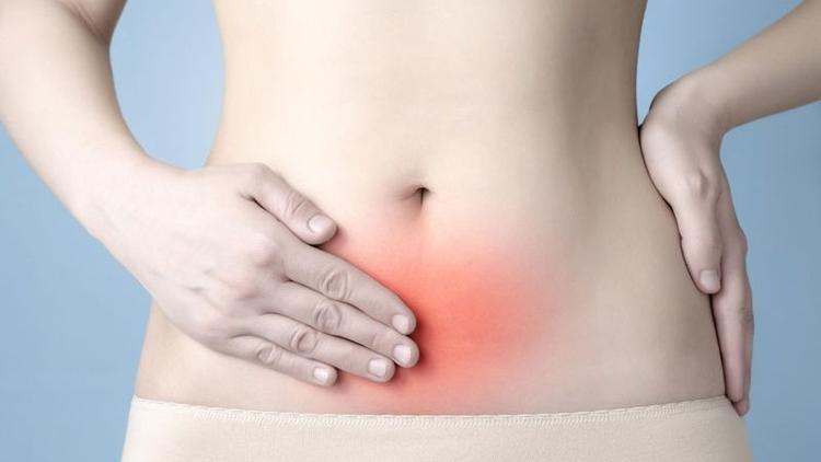 Endometriosis (çikolata kisti) nedir?