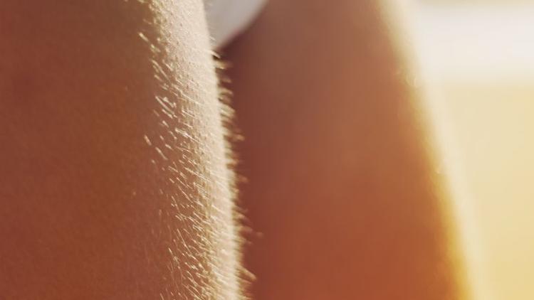 Hirsutizm nedir? Hirsutizm belirtileri nelerdir?