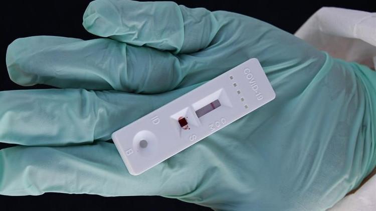 Koronavirüsü saniyeler içinde tespit eden test!