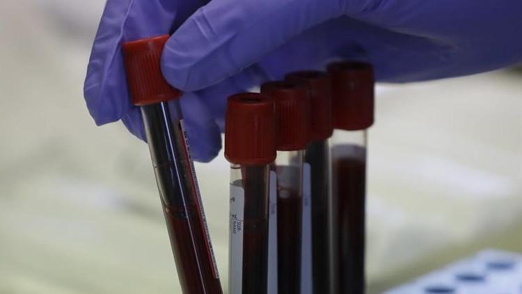 Japonya ABD'li ilaç devi Pfizer ile Covid-19 aşısı anlaşmasına vardı