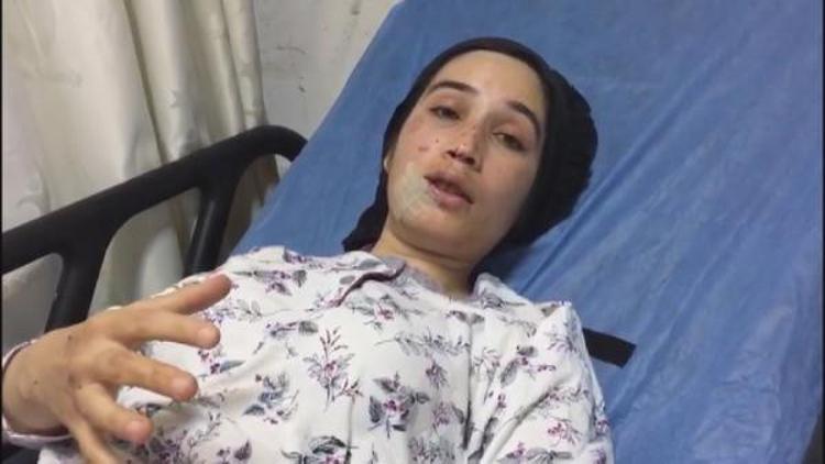 Otobüs kazasında yaralanan kadın: Şoför acele ediyordu, biraz da hızlı sürüyordu
