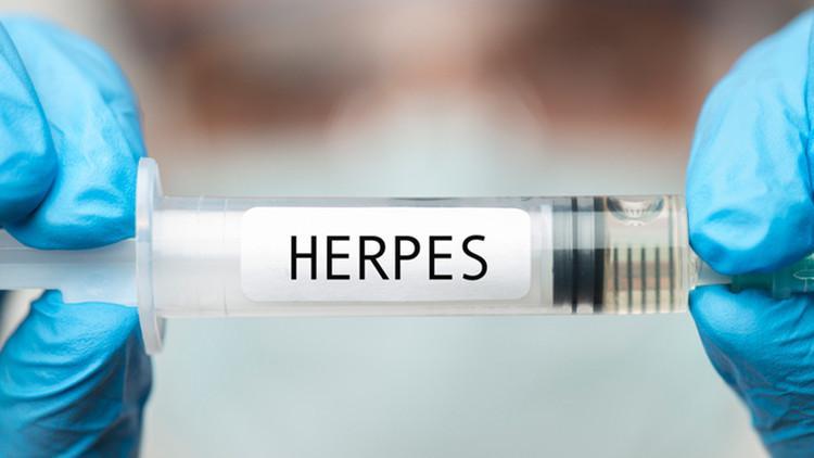 Genital herpes enfeksiyonları