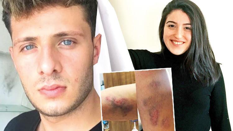 Koronalı dehşet! ‘Bana bakmak zorundasınız’ dedi, sağlıkçıları darp etti...