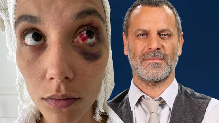 Uzlaşma yolunu seçmediler! Ozan Güven ve Deniz Bulutsuz davası devam ediyor...