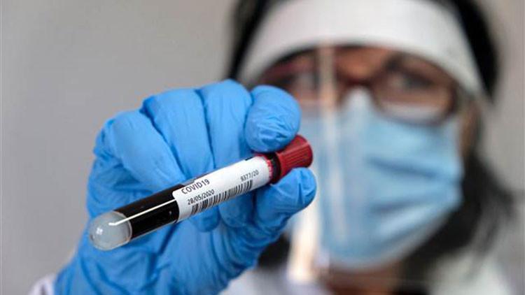 DSÖ Genel Direktörü Ghebreyesus'tan flaş 'koronavirüs testi' açıklaması