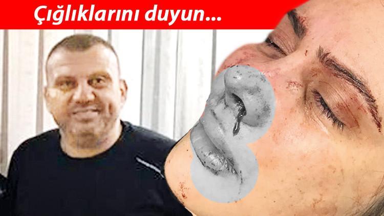 Kahreden soru: Ya o silah bu kez tutukluk yapmazsa?