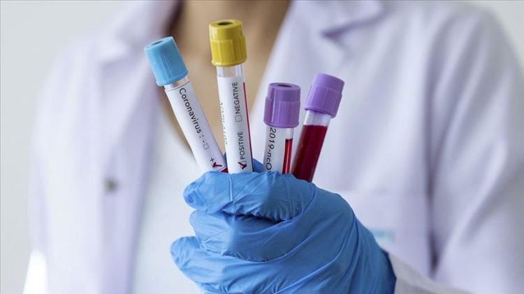Kovid-19'dan ölenlerin sayısı dünya genelinde 1 milyon 100 bini geçti