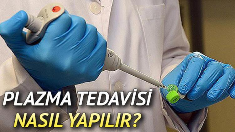 Koronavirüs hastalarında immün plazma tedavisi nasıl uygulanıyor?